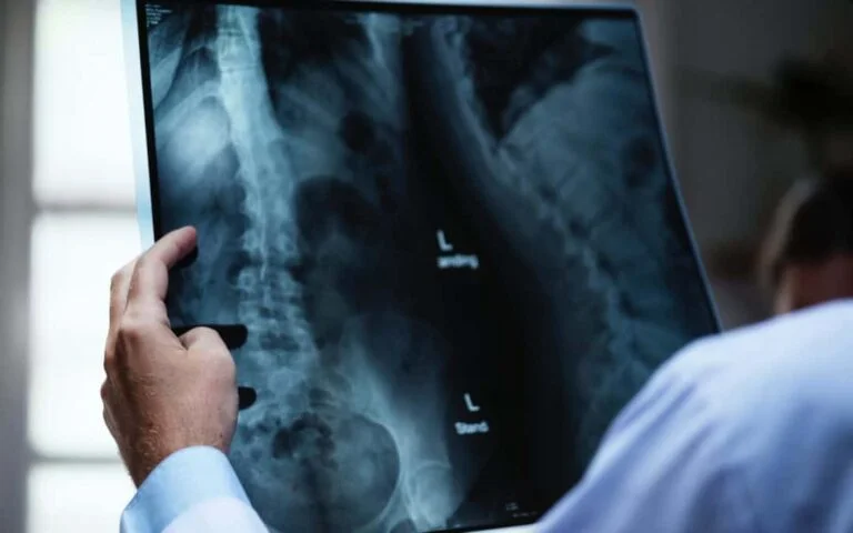 Recognizing Signs of a Spinal Cord Injury